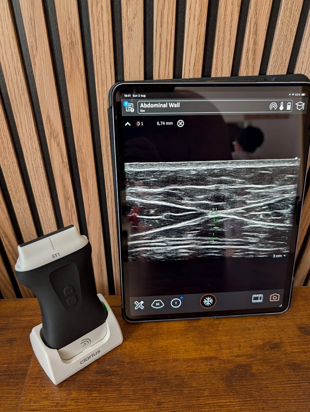 Wireless ultrasound probe and a tablet showing an abdominal wall scan with a visceral fat measurement on screen